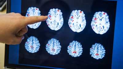 أزمة صامتة تضرب أميركا.. ارتفاع مقلق في الإعاقات الإدراكية