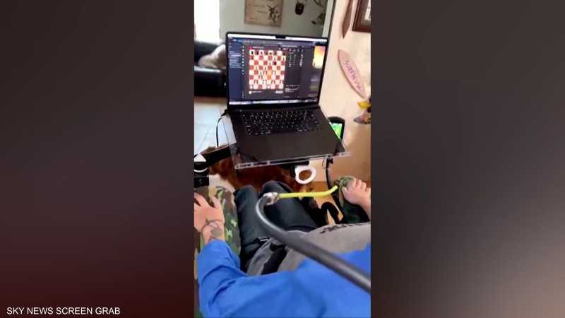 يلعب الشطرنج "بمخه".. والفضل لشريحة دماغية