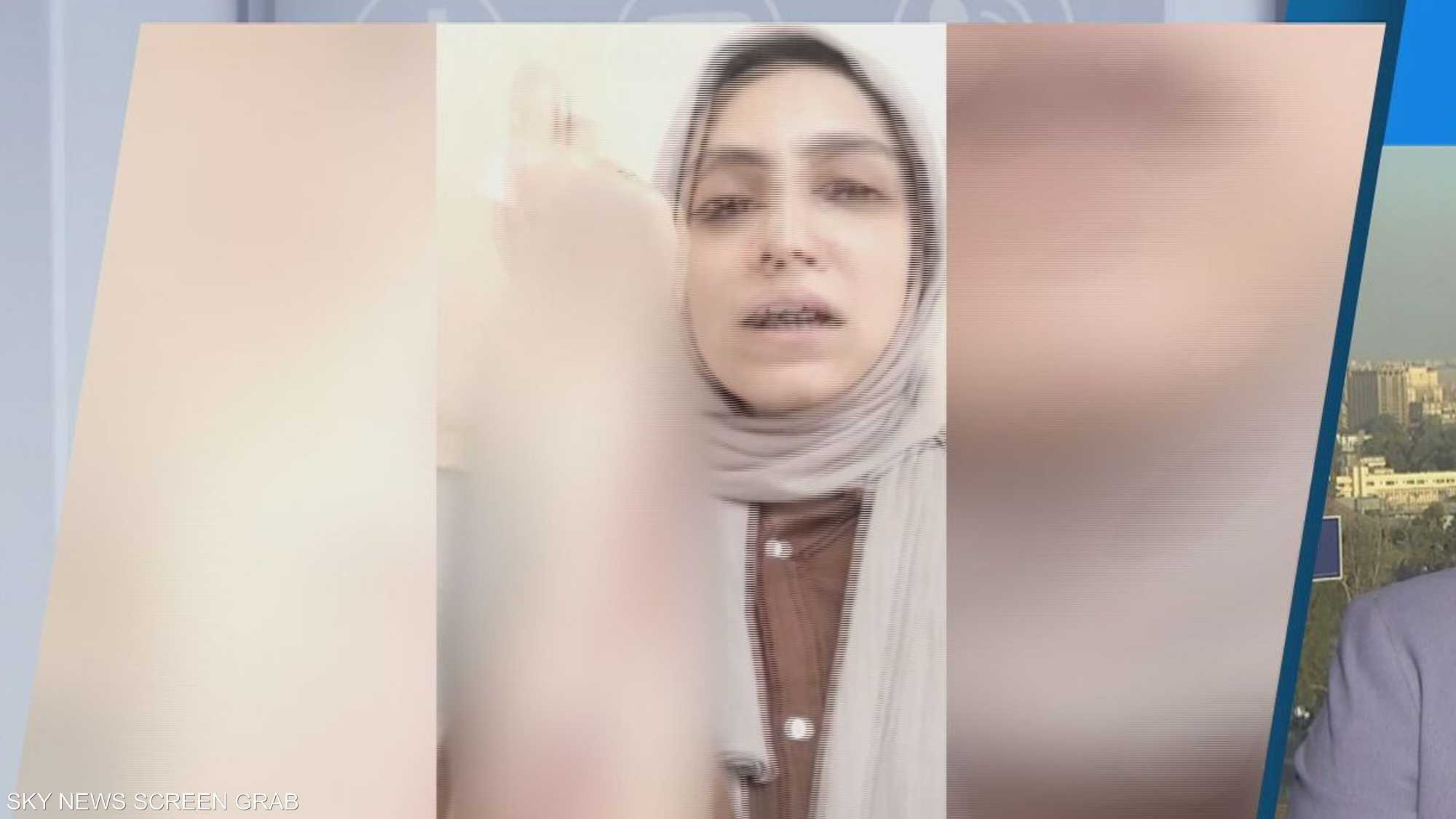 اعتداء وحشي على طبيبة أسنان في مصر يثير موجة غضب