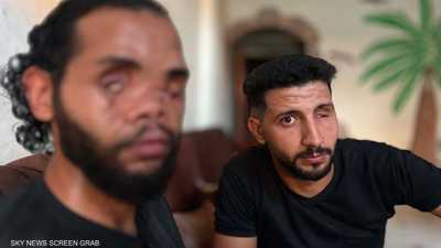 عام في الظلام.. شقيقان ينتظران علاجا خارج غزة